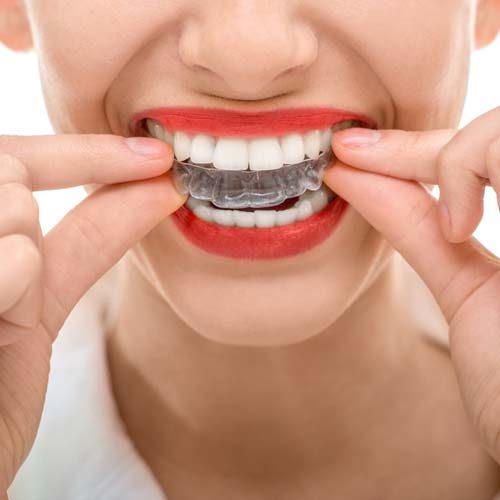Woman Putting on Invisalign Tray